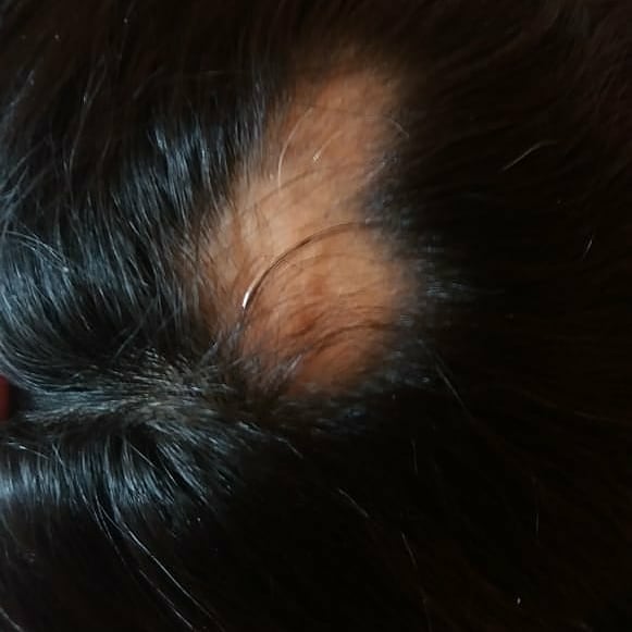 Hair oil 